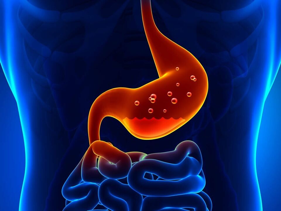 Gastritis ist eine entzündliche Erkrankung des Magens, die eine Diät erfordert